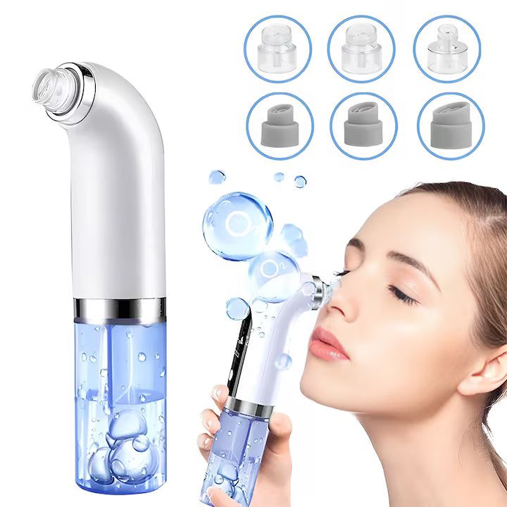 PoreClear™ Pro Blackhead Remover – Upgraded Pore Vacuum Suction for Clear, Glowing Skin